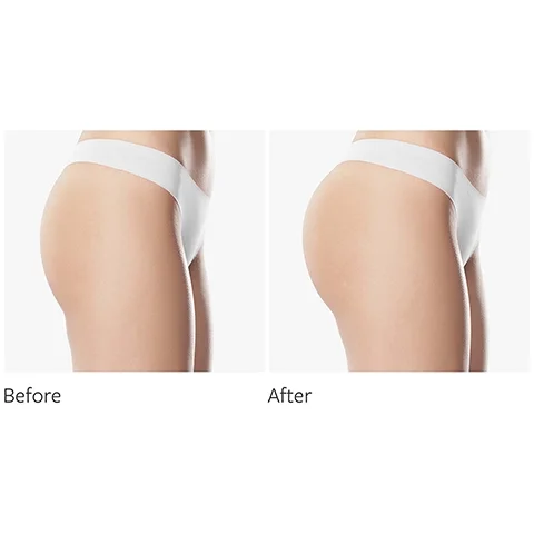 before and after