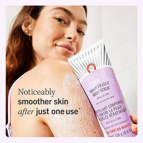 Image 1, noticeably smoother skin after just one use. image 2, instantly smooths bumps associated with KP for softer feeling skin. image 3, 95% said their skin felt softer than it had ever been. before and after. image 4, formulated with pumice glycolic and lactic acids bisabolol. image 5, what is KP? keratosis pilaris also known as chicken skin or stawberry skin is a common skin condition that causes dry, rough patches and tiny hard bumps on the skin.