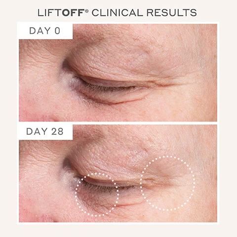 Image 1 - Image comparison showing clinical results of a treatment for eyelids, with the top image labeled DAY 0 displaying a close-up of an eye with visible wrinkles, and the bottom image labeled DAY 28 showing the same eye with reduced wrinkles, highlighted with dotted circles.
Image 2 - Image shows before-and-after photos of a mans forehead, with the left side labeled DAY 0 showing more prominent lines, and the right side labeled DAY 28 displaying reduced lines, with dotted circles highlighting the differences. Visible text includes LIFTOFF® CLINICAL RESULTS and the labels DAY 0 and DAY 28.
Image 3 - Side-by-side comparison of a persons face showing clinical results of a skincare treatment, labeled Day 0 on the left and Day 28 on the right, with dotted circles highlighting areas of change.
Image 4 - Image of a person holding a pink facial device with metallic balls at the top, displaying the brand name MAGNITONE LONDON, alongside various benefits and features outlined on the right: clinically proven to improve skin firmness, a workout for your face, just 5 minutes/day to see results, microcurrent technology, 4 strength settings, hypoallergenic skin contacting points, 5 second timer, USB rechargeable.
Image 5 - A smiling woman with freckles is holding a microcurrent facial toning device against her cheek, with text that reads LIFTOFF Microcurrent Facial Toning Device In a clinical study of 20 participants, regular use of the Magnitone LiftOff with the Super Conductive Gel was shown to Significantly firm skin by up to 47% With regular use over 4 weeks. Individual results will vary.
Image 6 - A smiling young man uses a facial toning device on his cheek, while a few skincare award badges are visible including a platinum beauty award for 2024, a clever skincare award for best facial toning tool in 2021, and a badge stating clinically proven and menopause friendly.