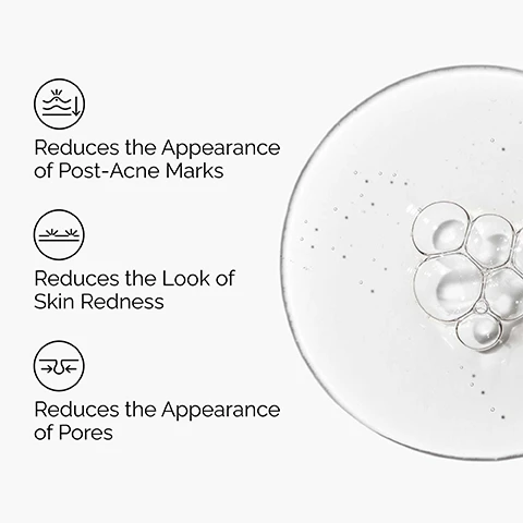 Image 1 - The image presents three skincare benefits on a white background, each with a small icon, next to a close-up of a clear, bubbly liquid; the benefits listed are Reduces the Appearance of Post-Acne Marks, Reduces the Look of Skin Redness, and Reduces the Appearance of Pores. Image 2 - A close-up of a persons face shows an eye, cheek, and fingers gently touching the skin where a clear liquid is visible, with three white text boxes listing Post-Acne Marks, Uneven Skin Tone, and Textural Irregularities. Image 3 - A clear dropper containing a bubbly liquid serum with a drop forming at its tip is shown next to text that reads Key ingredients in Aloe 2% + NAG 2% Solution: Aloe Barbadensis Leaf Juice Powder, Promotes skin hydration, and N-Acetyl Glucosamine, An amino-acid derivative that promotes even skin tone and texture. Image 4 - The image displays a three-step skincare regimen by The Ordinary for A regimen for oily, blemish-prone skin, showing products horizontally arranged: PREP features a white tube labeled Glucoside Foaming Cleanser, described as Cleanses skin and maintains barrier; TREAT includes a white dropper bottle labeled Niacinamide 10% + Zinc 1% High-Strength Vitamin and Mineral Blemish Formula, which Reduces excess oil and pore visibility, and a brown dropper bottle labeled Aloe 2% + NAG 2% Solution A Soothing Serum for Blemish-Prone Skin, which Reduces the appearance of post-acne marks; SEAL displays a grey tube labeled Natural Moisturizing Factors + Beta Glucan Light Surface Hydration Formula, described as a Lightweight gel moisturizer to support surface hydration.