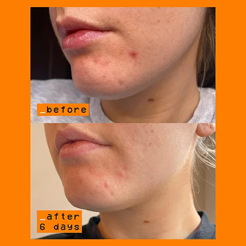 before and after 6 days