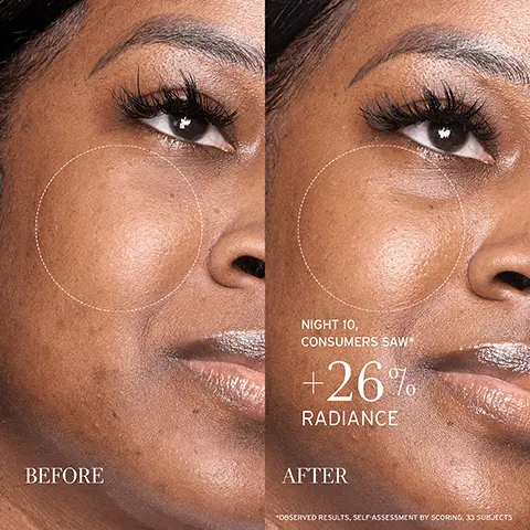 Image 1, BEFORE NIGHT 10, CONSUMERS SAW* +267 RADIANCE AFTER *OBSERVED RESULTS, SELF-ASSESSMENT BY SCORING, 33 SUBJECTS Image 2, RESURFACES NIGHTLY. Gentle on skin. fresh LOTUS YOUTH PRESERVE RESURFACING DREAM SERUM GENTLY EXFOLIATES &BOOSTS RADIANCE SERUM DE REVE RESURRACANT ANTI-AGE AU LOTS NIGHT 1* +23% SMOOTHER TEXTURE ML-FLOZ *INSTRUMENTAL TEST, 31 SUBJECTS, AFTER 1 APPLICATION Image 3, A SERUM for every need NOURISHES & HYDRATES RESISTS & DIMINISHES SIGNS OF AGING EVENS TEXTURE & TONE fresh ROSE fresh TEA ELIXIR fresh LOTUS WITH SQUALANE WITH NIACINAMIDE WITH AHAS Image 4, STEP 1 Resurfaces while gentle on skin APPLY 2-3 PUMPS fresh LOTUS YOUTH PRESERVE DREAM FACE CREAM RECOVERS & RESETS SOML-1.6FLOZ STEP 2 fresh LOTUS YOUTH PRESERVE RESURFACING DREAM SERUM GENTLY EXFOLIATES &BOOSTS RADIANCE SERUM DE RÊVE RESURFACANT ANTI-AGE AU LOTUS 30ML-IFLOZ Visibly recovers from signs of fatigue SCOOP GENEROUS AMOUNT Image 5, WAKE UP TO smooth, radiant skin Duo of AHAS EXFOLIATES DIFFERENT LAYERS OF THE SKIN'S SURFACE Super Lotus SMOOTHES LINES & BOOSTS RADIANCE fresh LOTUS YOUTH PRESERVE RESURFACING DREAM SERUM GENTLY EXFOLIATES & BOOSTS RADIANCE SEAUM DE LEVE RESURFACANT ANTI-AGE AU LOTUS SML-FLOZ Image 6, BEFORE NIGHT 10, CONSUMERS SAW -16% LOOK OF DARK SPOTS AFTER *OBSERVED RESULTS, SELF-ASSESSMENT BY SCORING, 33 SUBJECTS Image 7, BEFORE NIGHT 10, CONSUMERS SAW* 16% LOOK OF DARK SPOTS AFTER *OBSERVED RESULTS, SELF-ASSESSMENT BY SCORING, 33 SUBJECTS