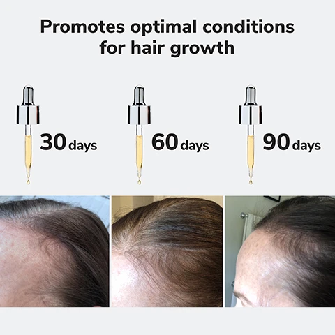 Image 3 - Image shows a graphic with three dropper bottles labeled 30 days, 60 days, and 90 days on top, along with side-by-side images of hair growth over the same time periods, with the text promoting optimal conditions for hair growth.
Image 4 - Image of a golden orb with text stating clinically proven to reduce shedding by up to 90% and an asterisk noted below for a study reference.
Image 5 - A close-up image of a iridescent serum bottle labeled COLOR WOW with text on the right stating ABSORBS INSTANTLY NO GREASY FEEL and icons indicating NO SILICONES, NO ALCOHOL, NO OILS, NO ADDED FRAGRANCE, VEGAN.
Image 6 - A dropper bottle with a black cap and yellow liquid sits on a reflective surface, accompanied by two circular puddles of the same liquid, with text that reads PROCAPIL® strengthens root-grip to reduce shedding and SYNTHETIC COLLAGEN moisturizes and mimics natural collagen.
Image 8 - An image of a glass bottle labeled YOUTH JUICE Collagen Scalp Treatment with a dropper, containing a golden liquid, and text stating Creates optimal conditions for hair growth + stronger, thicker, more resilient hair. Below the main label is COLOR WOW and additional text in French.
Image 9 - A person with long, wet hair is applying a dropper of hair treatment directly to their scalp, focusing on the hairline, with text on the side outlining usage instructions.