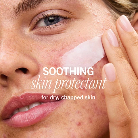 Image 1 - A close-up of a persons face applying a cream to their cheek, with visible text that says SOOTHING skin protectant for dry, chapped skin.
Image 2 - Close-up of a tube opening with white cream at the tip, with text that reads Formulated with 1% Dimethicone for instant skin relief.
Image 3 - A young woman with freckles and acne applies cream to her cheek, smiling softly, with the text soothes IRRITATION from prescription-strength acne + retinoid treatments visible in the image.
Image 4 - A hand holds a dollop of creamy white substance being squeezed from a metal tube, with the words rich + luxurious yet breathable formula prominently displayed in red text.
Image 5 - A close-up of a persons eye showcases the skin around the eye before and after treatment, with visible improvements, labeled as BEFORE on the left and IMMEDIATELY AFTER on the right, with the text STRENGTHENS damaged skin barrier above.
Image 6 - A blue tube of cream with the text Colloidal Oatmeal and the statement Improves skin surface renewal 2x faster* is shown, with white cream squeezed out from the tubes opening.
Image 7 - A smiling person with a light skin tone has cream applied to their face, with visible text stating non-comedogenic + wont clog pores.
Image 8 - Two tubes of First Aid Beauty Ultra Repair Rescue Barrier Balm on a white background, one labeled as travel size and the other as full size, with a small amount of cream displayed beside them.
Image 9 - Image shows two moisturizer products, the first is a white jar labeled Ultra Repair Cream with text indicating use for daily hydration, and the second is a blue tube labeled Ultra Repair Rescue Barrier Balm for emergency use, with visible text describing its benefits for dry, sensitive skin.