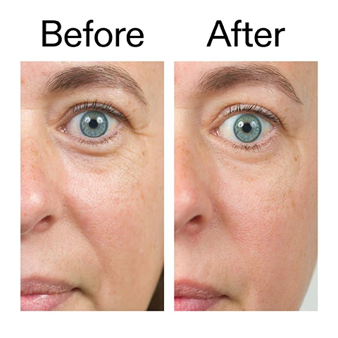 Image 1 - Close-up comparison of a womans face showing her eye, cheek, and nose, with the left side displaying more visible wrinkles around the eye and cheek, and the right side showing smoother skin with fewer wrinkles, accompanied by the text Before After. Image 2 - A close-up of a persons face with wet skin and a hand gently touching their cheek, next to text that reads Clinically proven to reduce skin redness by 22% after just 2 weeks.* Instantly hydrates skin by up to 83% Clinically proven to visibly reduce fine lines and wrinkle depth in 4 weeks** *4-week independent consumer study of 22 people under dermatological and ophthalmological control **4-week clinical study of 20 people. Image 3 - A close-up of a persons face with their eyes closed, gently rubbing their eyelids with their fingers, alongside text that reads: Why we love Oat Cleansing Balm. Melts waterproof makeup and SPF. Rich, buttery texture. Suitable for all skin types, even sensitive. Image 4 - A close-up of a persons eye with a finger gently touching the skin beneath it, next to text that reads Why we love Hyaluronic Acid Serum, Non sticky and light weight, Boosts your routine, Fast-absorbing and instantly hydrates. Image 5 - A close-up of a persons face with a serum droplet on their cheek, next to text that reads: Why we love Retinol Serum, Reduces signs of aging without irritation, Hydrating, lightweight texture, Perfect for retinol beginners. Image 6 - A close-up of a persons smiling eyes and nose, with their hand gently touching their cheek, introduces the text Why we love Bio-Active Ceramide Moisturiser, listing that it smooths, firms, deeply hydrates, strengthens the barrier, and has a rich, non-greasy formula. Image 7 - A white background with a partial white cream swirl on the right, displaying a four-step anti-ageing PM skincare routine with the text: How to layer (PM) Intro Routine for Anti-ageing 1 Oat Cleansing Balm MASSAGE ONTO DRY SKIN TO BREAK DOWN MAKEUP, SPF AND IMPURITIES. RINSE WELL. 2 Hyaluronic Acid Serum APPLY TO DAMP SKIN TO KEEP SKIN HYDRATED AND HAPPY. 3 Retinol Serum APPLY A PEA-SIZED AMOUNT TO CLEAN, DRY SKIN - 2-3 NIGHTS A WEEK TO START. BUILD UP SLOWLY AND INCREASE TO NIGHTLY USE IF YOUR SKIN TOLERATES IT. 4 Bio-Active Ceramide Moisturiser LAYER ON TOP TO HELP SUPPORT SKIN REPAIR AND BOOST BARRIER FUNCTION. Image 8 - Four white and black The Inkey List skincare products, including a tube of Oat Cleansing Balm, a small bottle of Hyaluronic Acid Serum, a tube of Retinol Serum, and a jar of Bio-Active Ceramide Repairing and Plumping Moisturizer, are displayed on a dark, narrow shelf against a plain white background, with two circular red and white CEW.UK Beauty Award Winner 2024 stickers partially covering the top of the cleansing balm and the moisturizer; visible text on the items reads THE INKEY LIST OAT CLEANSING BALM 5.0 US fl.oz. / 150ml e Helps remove makeup and cleanse sensitive skin. Aide à démaquiller et nettoyer les peaux sensibles., CEW.UK BEAUTY AWARD WINNER 2024, HYALURONIC ACID SERUM 1.0 US fl.oz. / 30ml e THE INKEY LIST, THE INKEY LIST RETINOL SERUM 1.0 US fl.oz. / 30ml e Helps reduce the visible signs of aging. Aide à réduire les signes visibles de lâge., THE INKEY LIST BIO-ACTIVE CERAMIDE REPAIRING AND PLUMPING MOISTURIZER 1.7 US fl.oz. / 50ml e Visibly smooths and firms skin, whilst strengthening skin barrier., and CEW.UK BEAUTY AWARD WINNER 2024.